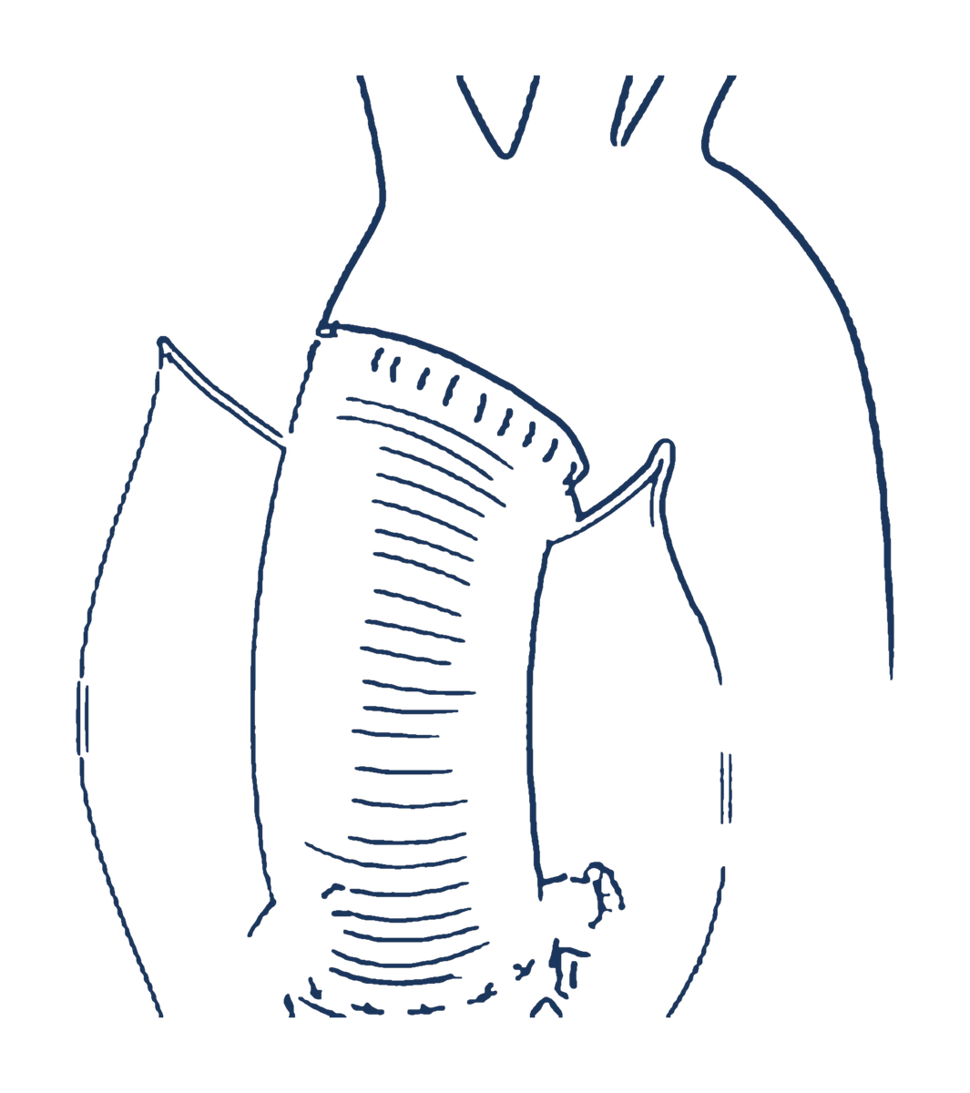 Illustration of the ascending aorta and aortic arch